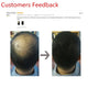 Hair Building Fiber Powder for Thinning Hair 100g