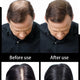 Hair Building Fiber Powder for Thinning Hair 100g