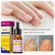 Fungal Nail Treatment Repair Serum