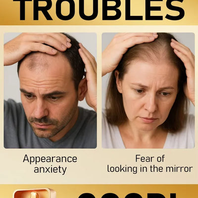 Hair Thickening and Restoration Treatment for Baldness