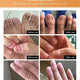 Fungal Nail Treatment Repair Serum