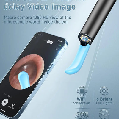 Ear Wax Removal Camera Tool with 1080P HD Lens
