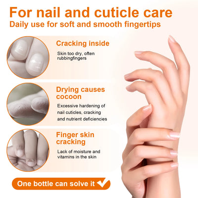 Honey Milk Cuticle Oil 30ml Dropper Nail Moisturizer