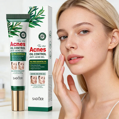 Tea Tree Acne Facial Cream Oil Control