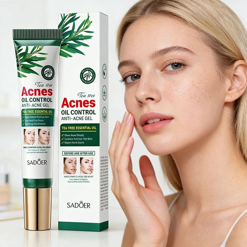 Tea Tree Acne Facial Cream Oil Control