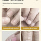 Fungal Nail Treatment Repair Serum