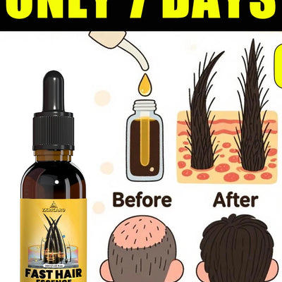 Hair Follicle Penetrating Hair Regeneration Treatment