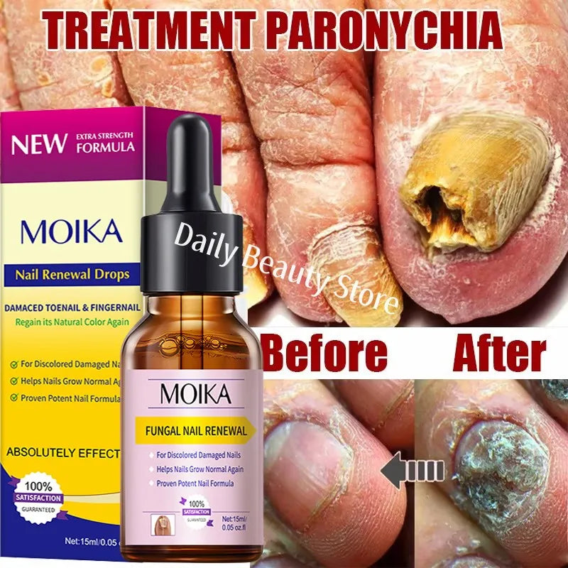 Fungal Nail Treatment Repair Serum