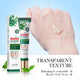 Tea Tree Acne Facial Cream Oil Control