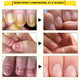 Fungal Nail Treatment Repair Serum