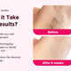 IPL Laser Hair Removal Machine Permanent and Painless