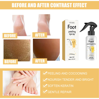 Foot Exfoliating Spray Callus Softener